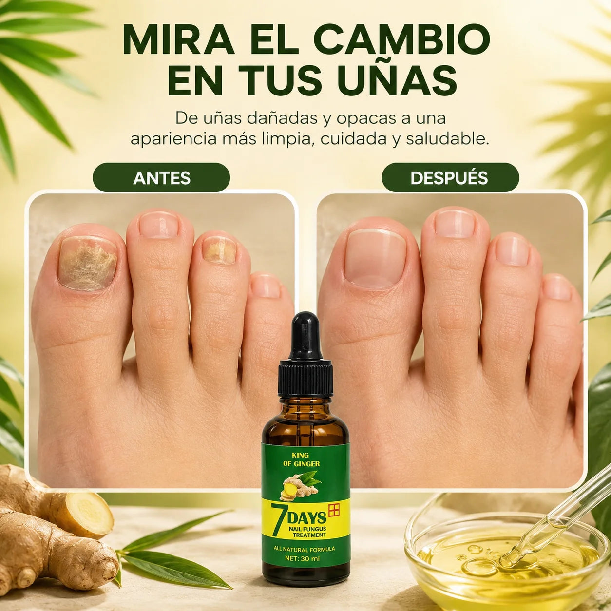 Adiós Hongos l Vuelve a lucir Uñas Sanas l Elimina en Solo 7 Días